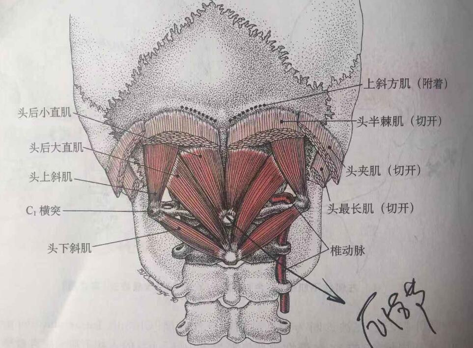 寰枕关节枕后肌肉解剖图