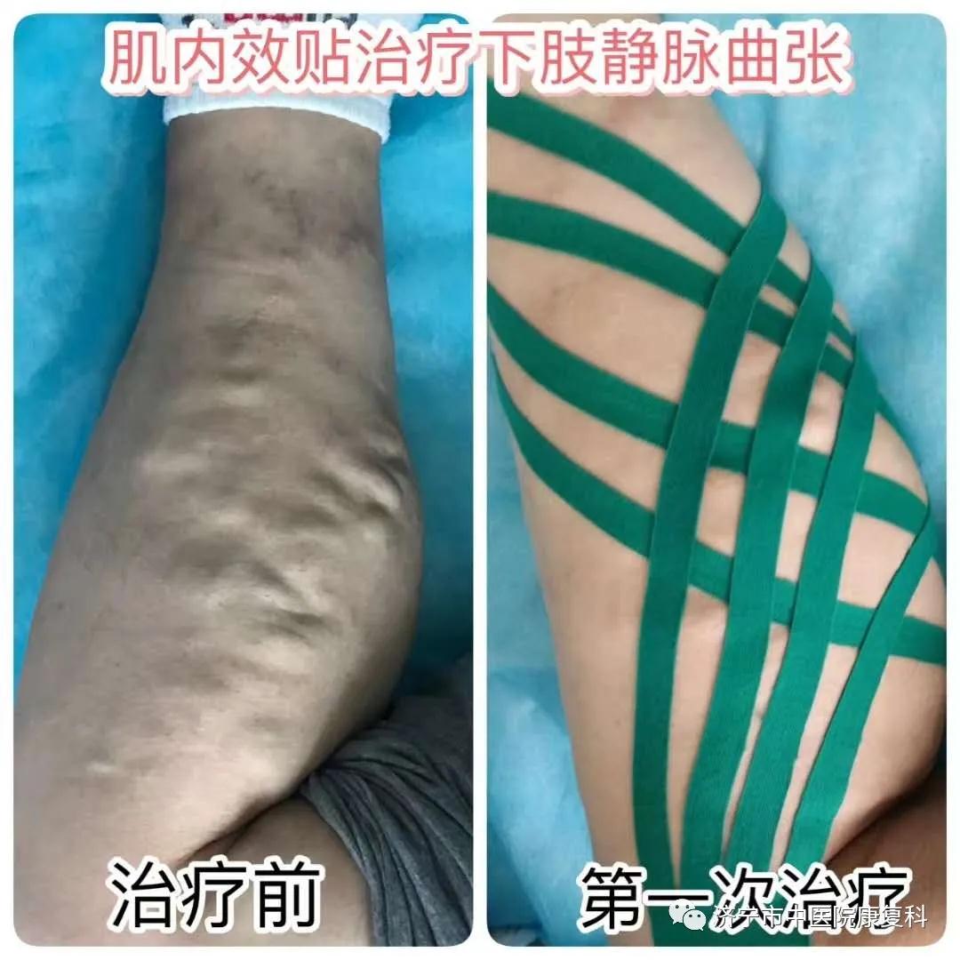 1585298287108569.jpg 微信图片_20200327142607.jpg
