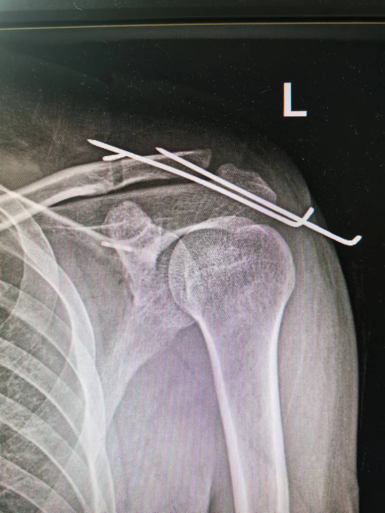 1661157776973378.jpg 微信图片_20220728154708.jpg